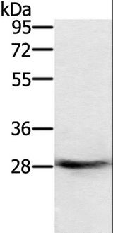 RAB8B Antibody - Western blot analysis of Human normal colon tissue, using RAB8B Polyclonal Antibody at dilution of 1:400.