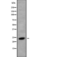 RAB8B Antibody - Western blot analysis of RAB8B using HeLa whole cells lysates