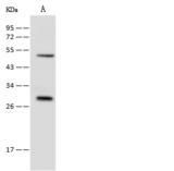 RAB8B Antibody - Anti-RAB8B rabbit polyclonal antibody at 1:500 dilution. Lane A: COLO205 Whole Cell Lysate. Lysates/proteins at 30 ug per lane. Secondary: Goat Anti-Rabbit IgG (H+L)/HRP at 1/10000 dilution. Developed using the ECL technique. Performed under reducing conditions. Predicted band size: 24 kDa.