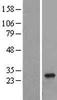 RAB8B Protein - Western validation with an anti-DDK antibody * L: Control HEK293 lysate R: Over-expression lysate