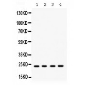 RAB9A / RAB9 Antibody - Western blot analysis of Rab9 expression in rat brain extract (lane 1), mouse brain extract (lane 2), HELA whole cell lysates (lane 3) and MCF-7 whole cell lysates (lane 4). Rab9 at 23 kD was detected using rabbit anti- Rab9 Antigen Affinity purified polyclonal antibody at 0.5 ug/mL. The blot was developed using chemiluminescence (ECL) method.