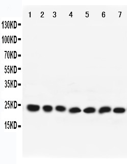 RAB9A / RAB9 Antibody - WB of RAB9A / RAB9 antibody. All lanes: Anti-RAB9A at 0.5ug/ml. Lane 1: Rat Brain Tissue Lysate at 40ug. Lane 2: Mouse Brain Tissue Lysate at 40ug. Lane 3: HELA Whole Cell Lysate at 40ug. Lane 4: PC12 Whole Cell Lysate at 40ug. Lane 5: NIH Whole Cell Lysate at 40ug. Lane 6: A431 Whole Cell Lysate at 40ug. Lane 7: 293T Whole Cell Lysate at 40ug. Predicted bind size: 23KD. Observed bind size: 23KD.