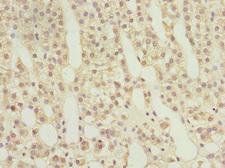 RAB9A / RAB9 Antibody - Immunohistochemistry of paraffin-embedded human adrenal gland tissue at dilution 1:100