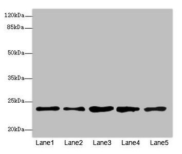RAB9A / RAB9 Antibody - Western blot All Lanes: RAB9Aantibody at 7.66ug/ml Lane 1 : Jurkat whole cell lysate Lane 2 : K562 whole cell lysate Lane 3 : HepG-2 whole cell lysate Lane 4 : 293T whole cell lysate Lane 5 : Hela whole cell lysate Secondary Goat polyclonal to Rabbit IgG at 1/10000 dilution Predicted band size: 23 kDa Observed band size: 23 kDa