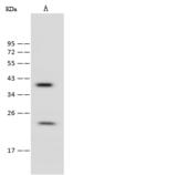 RAB9A / RAB9 Antibody - Anti-RAB9A rabbit polyclonal antibody at 1:500 dilution. Lane A: HeLa Whole Cell Lysate. Lysates/proteins at 30 ug per lane. Secondary: Goat Anti-Rabbit IgG (H+L)/HRP at 1/10000 dilution. Developed using the ECL technique. Performed under reducing conditions. Predicted band size: 22 kDa. Observed band size: 22 kDa.