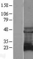 RAB9A / RAB9 Protein - Western validation with an anti-DDK antibody * L: Control HEK293 lysate R: Over-expression lysate