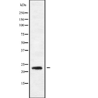 RAB9B Antibody - Western blot analysis of RAB9B using HepG2 whole cells lysates