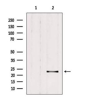 RAB9B Antibody - Western blot analysis of extracts of rat brain tissue using RAB9B antibody. Lane 1 was treated with the blocking peptide.