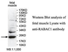 RABAC1 Antibody