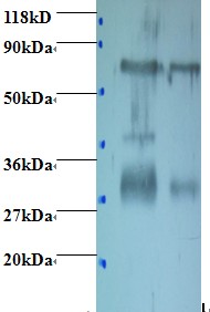 Chicken IgY Antibody - Western blot of Chicken Yolk Immunoglobulin Antibody at 2 ug/ml + egg yolk. Lane 1: egg yolk at 1:400. Lane 2: egg yolk at 1:100. Secondary: Goat polyclonal to Rabbit IgG at 1:15000 dilution.  This image was taken for the unconjugated form of this product. Other forms have not been tested.