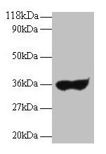 Human Ig Light Chain Antibody - Western blot All lanes: Human igg light chain antibody at 2µg/ml + Human serum Lane 1: Human serum at 1: 100 Lane 2: Human serum at 1: 500 Secondary Goat polyclonal to rabbit IgG at 1/10000 dilution Predicted band size: 35 kDa Observed band size: 35 kDa