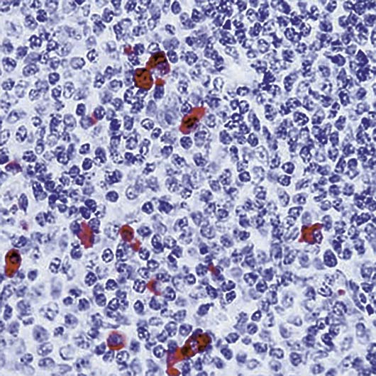 Human IgA Antibody - Formalin-fixed, paraffin-embedded human tonsil stained with IgA antibody.