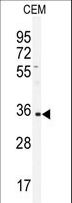 Human IgA1 Antibody - Western blot of IGHA1 antibody in CEM cell line lysates (35 ug/lane). IGHA1 (arrow) was detected using the purified antibody.