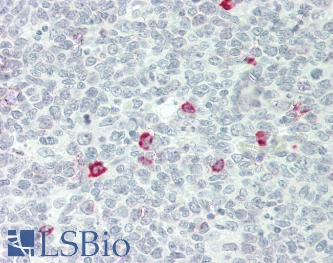 Human IgD Antibody - Human Tonsil: Formalin-Fixed, Paraffin-Embedded (FFPE)