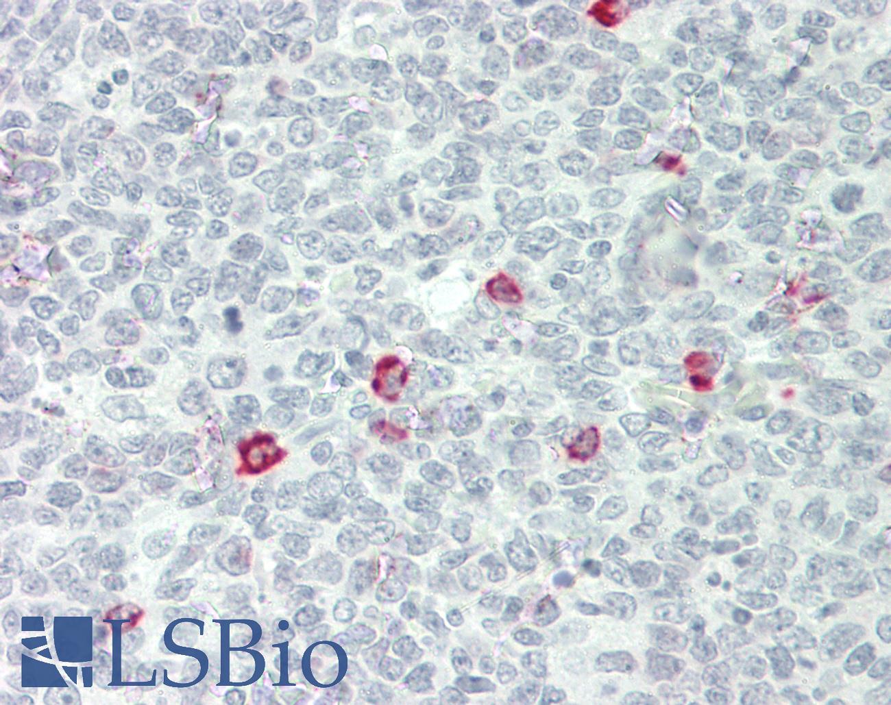 Human IgD Antibody - Human Tonsil: Formalin-Fixed, Paraffin-Embedded (FFPE)