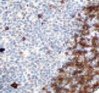 Human IgD Antibody - IHC of IgD on FFPE Tonsil Tissue. This image was taken for the unmodified form of this product. Other forms have not been tested.