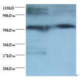 Human IgG Fc Antibody - Western blot of Human IgG Fc Fragment antibody at 2 ug/ml + Human serum. Lane 1: Human serum at 1:100. Lane 2: Human serum at 1:1000. Secondary: Goat polyclonal to Rabbit IgG at 1:15000 dilution.  This image was taken for the unconjugated form of this product. Other forms have not been tested.