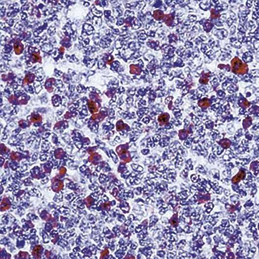 Human IgG Antibody - Formalin-fixed, paraffin-embedded human tonsil stained with IgG antibody.