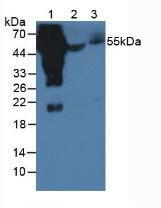 Human IgG4 Antibody - Western Blot; Sample: Lane1: Human Serum; Lane2: Porcine Serum; Lane3: Mouse Serum.