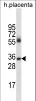Human IgG4 Antibody - IGHG4 Antibody western blot of human placenta tissue lysates (35 ug/lane). The IGHG4 antibody detected the IGHG4 protein (arrow).