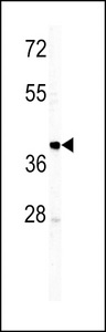Human IgM Antibody - Western blot of IGHM antibody in T47D cell line lysates (35 ug/lane). IGHM (arrow) was detected using the purified antibody.