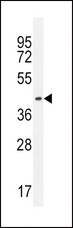 IGHG1 / IgG Antibody - IGHG1 Antibody western blot of HL-60 cell line lysates (35 ug/lane). The IGHG1 antibody detected the IGHG1 protein (arrow).