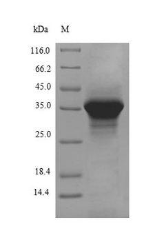 APOE / Apolipoprotein E Protein - (Tris-Glycine gel) Discontinuous SDS-PAGE (reduced) with 5% enrichment gel and 15% separation gel.