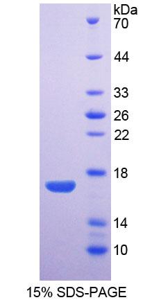 AQP1 / Aquaporin 1 Protein - Recombinant  Aquaporin 1, Colton Blood Group By SDS-PAGE