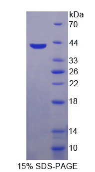 CCL4 / MIP-1 Beta Protein - Recombinant  Macrophage Inflammatory Protein 1 Beta By SDS-PAGE