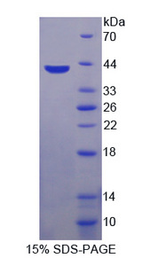CCL4 / MIP-1 Beta Protein - Recombinant  Macrophage Inflammatory Protein 1 Beta By SDS-PAGE