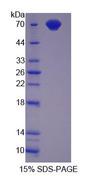 CD4 Protein - Recombinant Cluster Of Differentiation 4 By SDS-PAGE