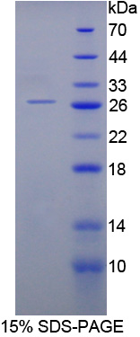 CNTF Protein - Recombinant  Ciliary Neurotrophic Factor By SDS-PAGE