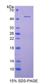Complement C9 Protein - Recombinant  Complement Component 9 By SDS-PAGE
