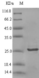 CXCL9 / MIG Protein - (Tris-Glycine gel) Discontinuous SDS-PAGE (reduced) with 5% enrichment gel and 15% separation gel.