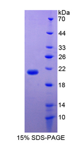 F7 / Factor VII Protein - Recombinant  Coagulation Factor VII By SDS-PAGE