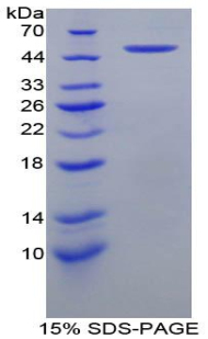 F9 / Factor IX Protein - Recombinant Coagulation Factor IX By SDS-PAGE