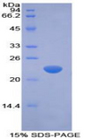 IFN Beta / Interferon Beta Protein - Recombinant Interferon Beta By SDS-PAGE