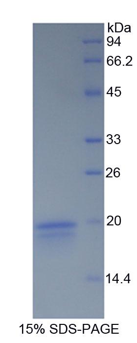 IFN Gamma / Interferon Gamma Protein - Recombinant Interferon Gamma By SDS-PAGE