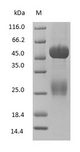 Rabbit IgG Protein - (Tris-Glycine gel) Discontinuous SDS-PAGE (reduced) with 5% enrichment gel and 15% separation gel.