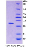 IL-1B / IL-1 Beta Protein - Recombinant Interleukin 1 Beta By SDS-PAGE