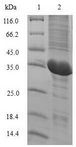 IL2 Protein - (Tris-Glycine gel) Discontinuous SDS-PAGE (reduced) with 5% enrichment gel and 15% separation gel.
