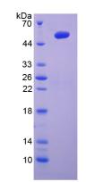 IL6 / Interleukin 6 Protein - Recombinant Interleukin 6 By SDS-PAGE