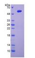 IL6 / Interleukin 6 Protein - Recombinant Interleukin 6 By SDS-PAGE