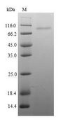 ITGB8 / Integrin Beta 8 Protein - (Tris-Glycine gel) Discontinuous SDS-PAGE (reduced) with 5% enrichment gel and 15% separation gel.