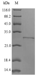 ITGB8 / Integrin Beta 8 Protein - (Tris-Glycine gel) Discontinuous SDS-PAGE (reduced) with 5% enrichment gel and 15% separation gel.