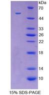 LGALS3 / Galectin 3 Protein - Recombinant  Galectin 3 By SDS-PAGE