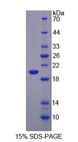 MMP9 / Gelatinase B Protein - Recombinant  Matrix Metalloproteinase 9 By SDS-PAGE
