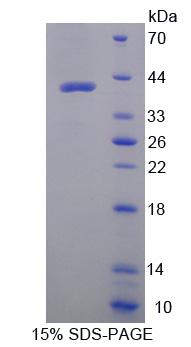 Osteocalcin Protein - Recombinant  Osteocalcin By SDS-PAGE