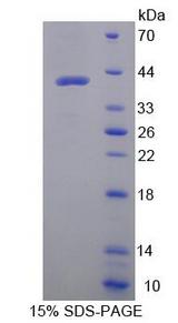 Osteocalcin Protein - Recombinant  Osteocalcin By SDS-PAGE