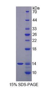 S100A12 Protein - Recombinant  S100 Calcium Binding Protein A12 By SDS-PAGE